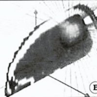 Fig. 1. Tratamiento conformado tridimensional radiante (caso 4). A. Ubicación espacial de la lesión. B. Imagen 3D sobre corte parasagital. C. Imagen 3D sobre corte coronal.