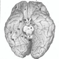 Fig. 3: Cara inferior del cerebro. 